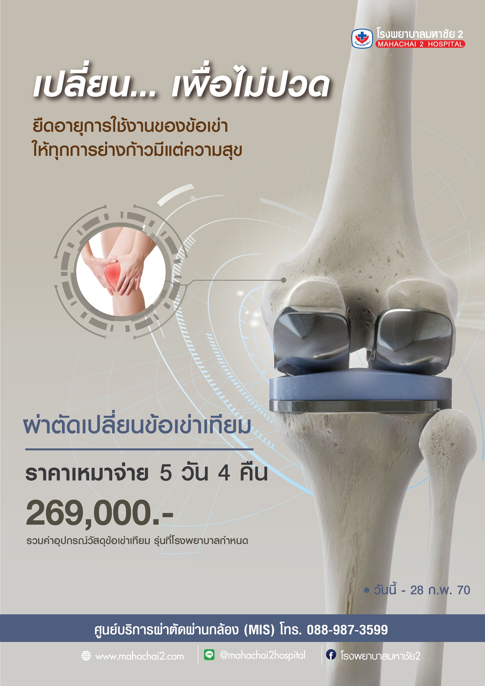 ผ่าตัดเปลี่ยนข้อเข่าเทียม